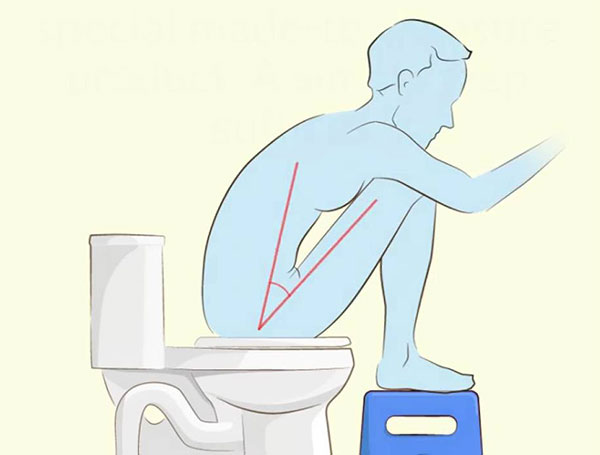 Ngồi vệ sinh đúng cách giúp điều trị bệnh trĩ 1